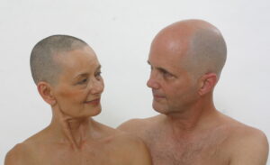 Image of a man and a woman with bald heads.